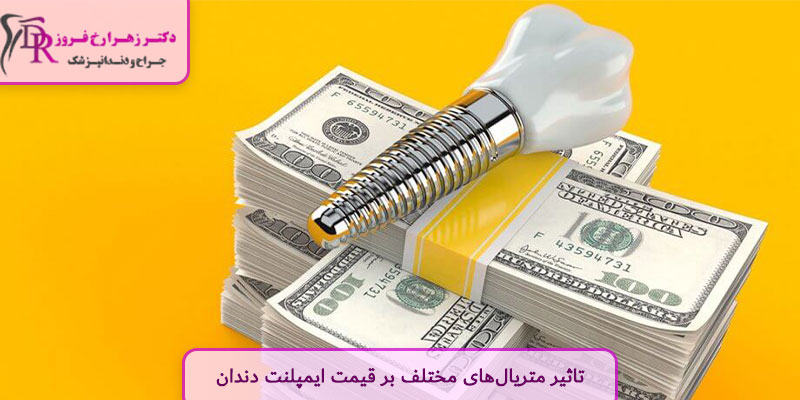 تاثیر متریال‌های مختلف بر قیمت ایمپلنت دندان