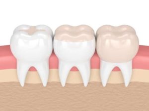 بهترین دندانپزشک بایومیمتیک در قزوین