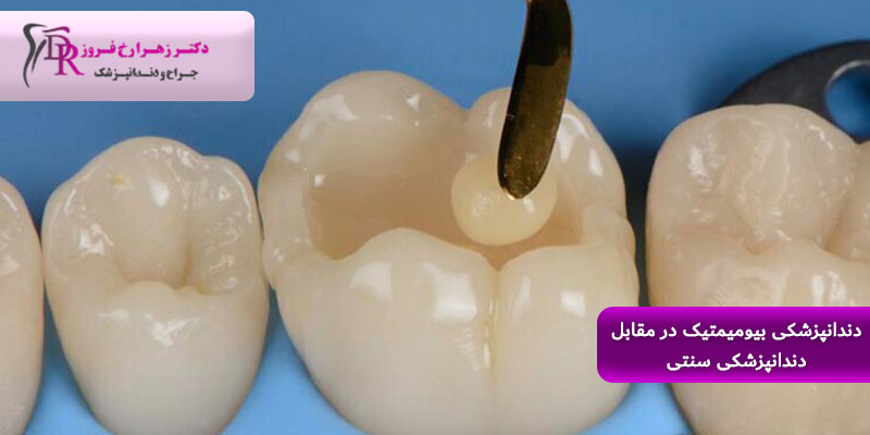 دندانپزشکی بیومیمتیک در مقابل دندانپزشکی سنتی