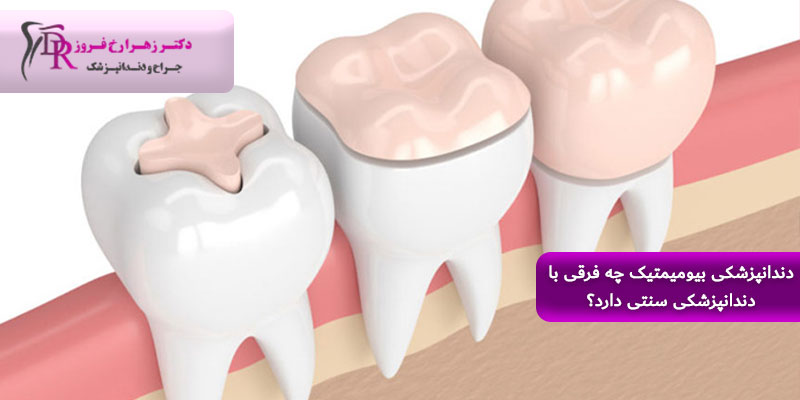 دندانپزشکی بیومیمتیک چه فرقی با دندانپزشکی سنتی دارد؟