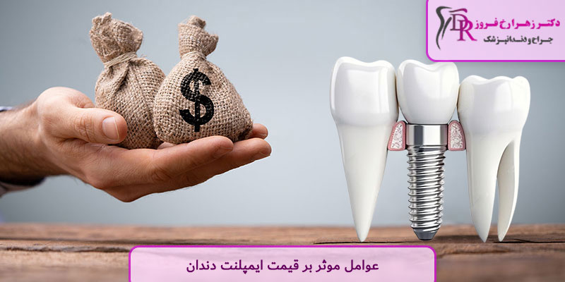 عوامل موثر بر قیمت ایمپلنت دندان