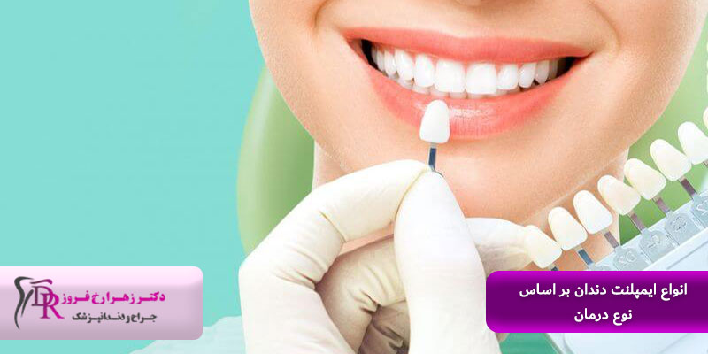 لمینت دندان چیست و چگونه انجام می‌شود؟