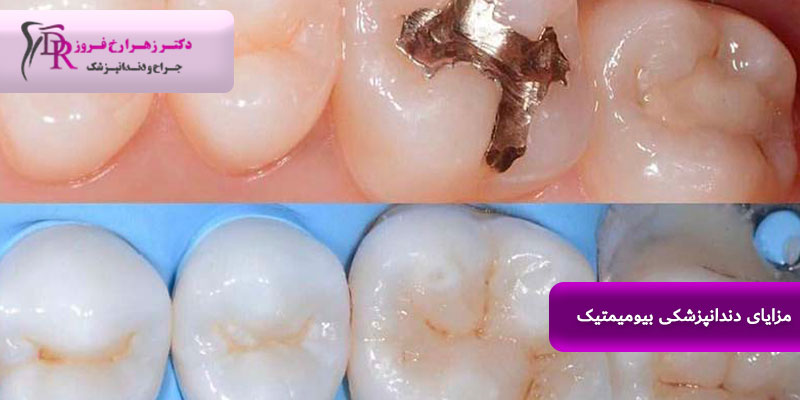 بهترین دندانپزشک بایومیمتیک در قزوین