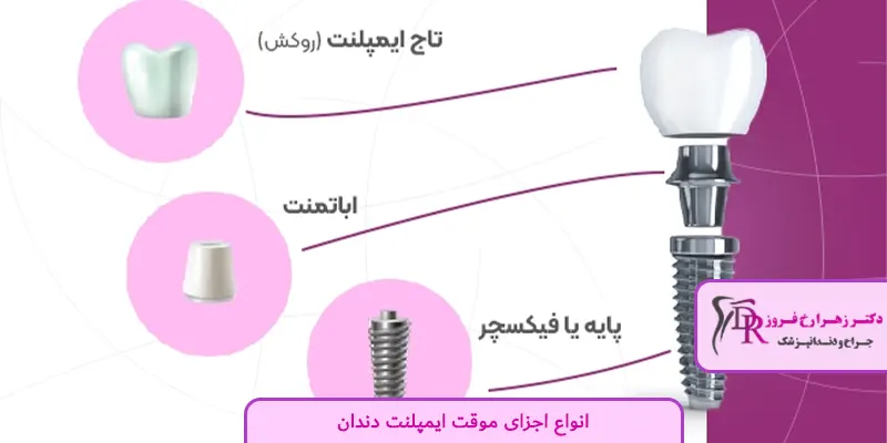 انواع اجزای موقت ایمپلنت دندان