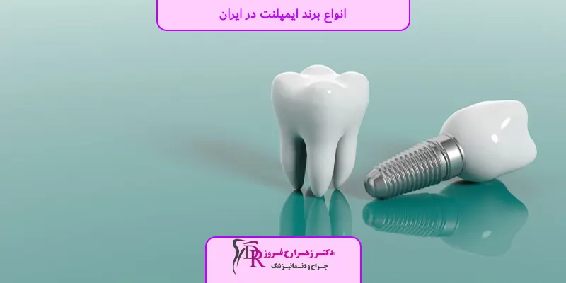 انواع برند ایمپلنت در ایران