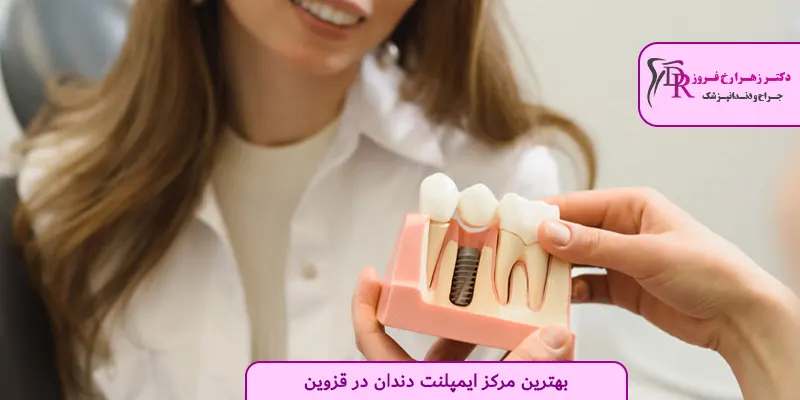 بهترین مرکز ایمپلنت دندان در قزوین