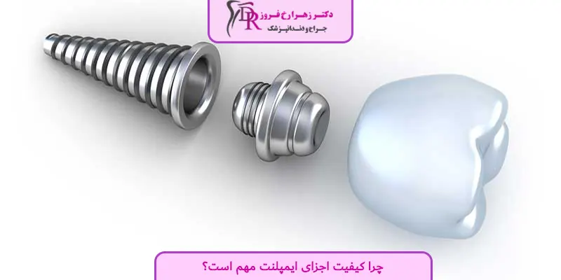 چرا کیفیت اجزای ایمپلنت مهم است؟