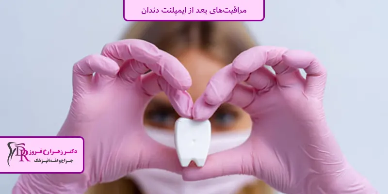 مراقبت‌های بعد از ایمپلنت دندان 