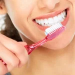 مراقبت‌های بعد از ایمپلنت دندان