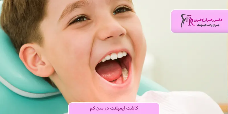 کاشت ایمپلنت در سن کم