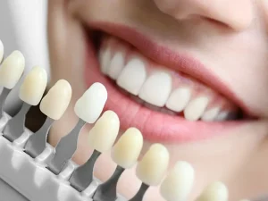 تفاوت لمینت و کامپوزیت