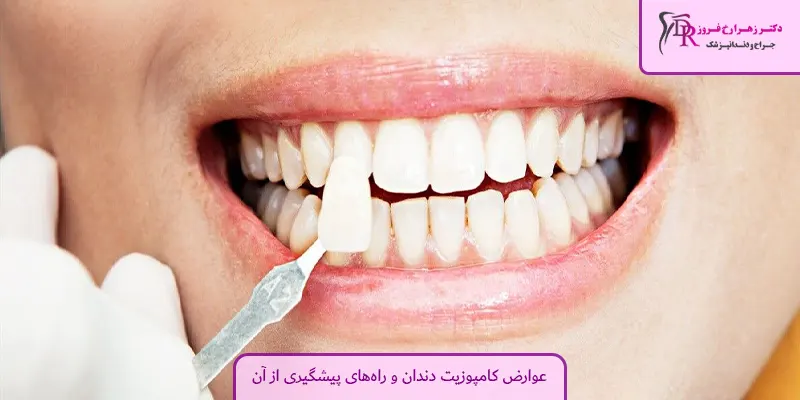 عوارض کامپوزیت دندان و راه‌های پیشگیری از آن