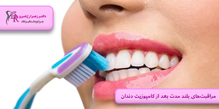 مراقبت‌های بلند مدت بعد از کامپوزیت دندان