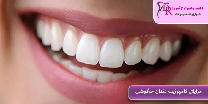 مزایای کامپوزیت دندان خرگوشی
