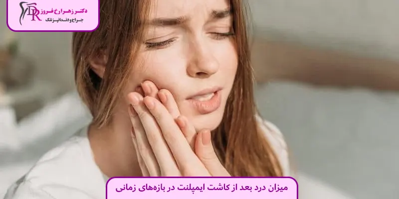 میزان درد بعد از کاشت ایمپلنت در بازه‌های زمانی مختلف