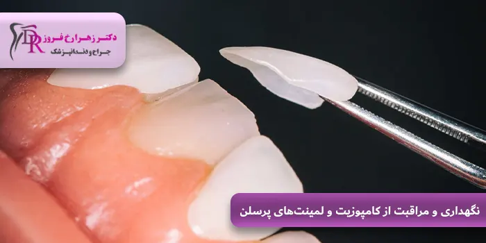 نگهداری و مراقبت از کامپوزیت و لمینت‌های پرسلن