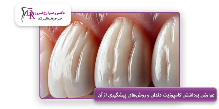 عوارض برداشتن کامپوزیت دندان و روش‌های پیشگیری از آن