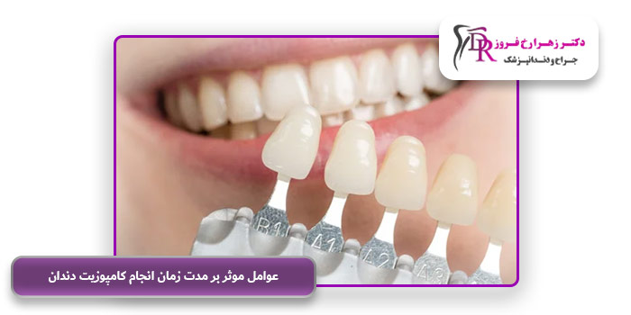 عوامل موثر بر مدت زمان انجام کامپوزیت دندان