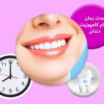 مدت زمان انجام کامپوزیت دندان