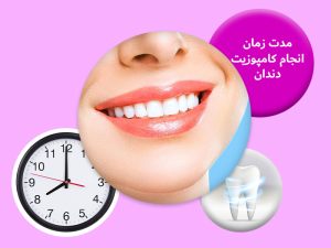 مدت زمان انجام کامپوزیت دندان