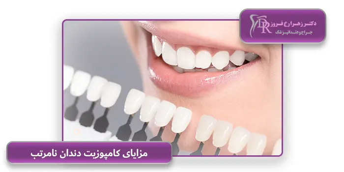 مزایای کامپوزیت دندان نامرتب 