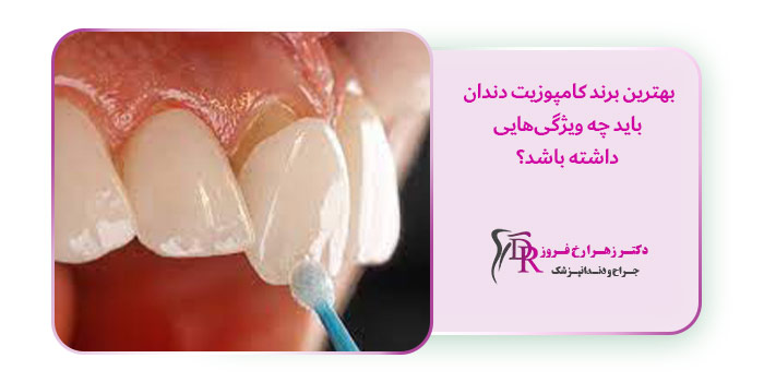 بهترین برند کامپوزیت دندان باید چه ویژگی‌هایی داشته باشد؟