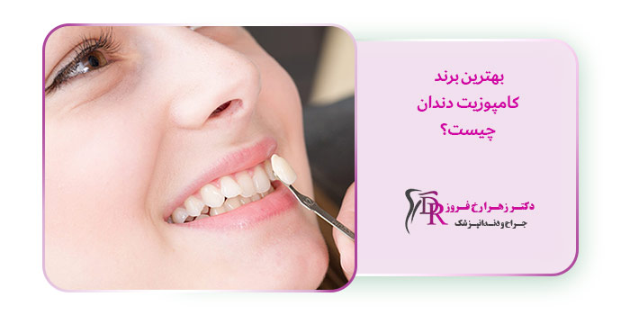 بهترین برند کامپوزیت دندان چیست؟