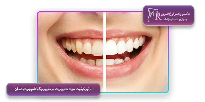 تاثیر کیفیت مواد کامپوزیت بر تغییر رنگ کامپوزیت دندان