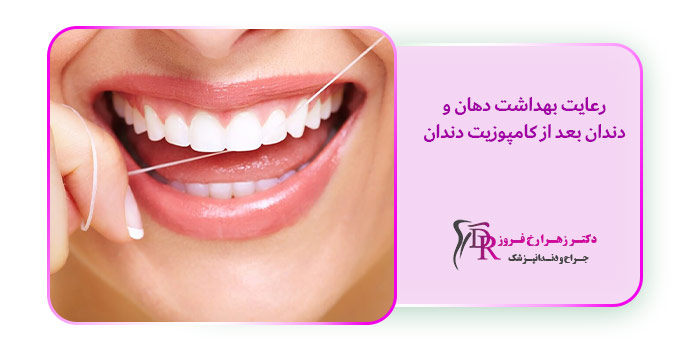 رعایت بهداشت دهان و دندان بعد از کامپوزیت