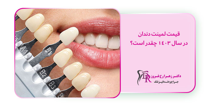 قیمت لمینت دندان در سال 1403 چقدر است؟