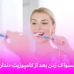 مسواک زدن بعد از کامپوزیت دندان