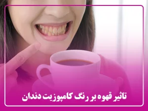 تاثیر قهوه بر رنگ کامپوزیت دندان