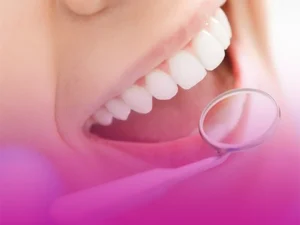 طول عمر لمینت دندان
