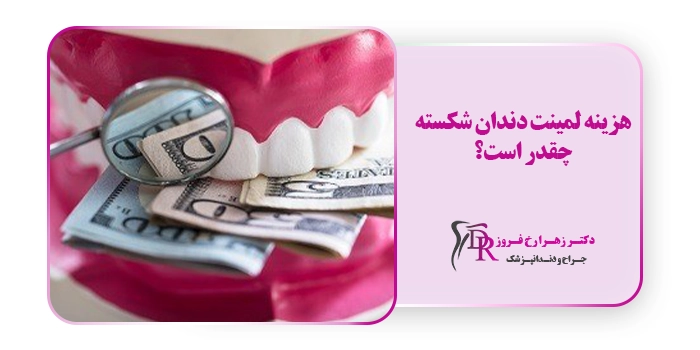 هزینه لمینت دندان شکسته چقدر است؟